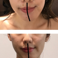 コルギ 日本の創始 日本骨気協会